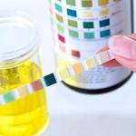 BANDELETTES URINAIRES 5 paramètres : Glucose - Protéine - Acétone -Sang - pH